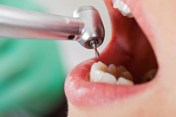 Best Emergency Dentist for Special Needs Patients in Navy Yard City, WA